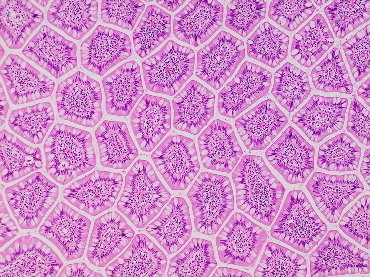 A stained histology slide showing finger-like villi projecting from the intestinal wall, each one a fold of tissue increasing the absorbing surface.